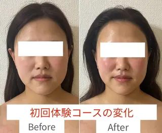 la lumie're (ラ リュミエール)所属・小顔サロン (ラ リュミエール)のエステ・リラクイメージ