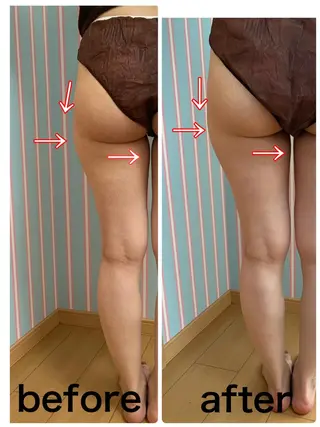 痩身/脱毛/ネイル HARUKAのエステ・リラクイメージ