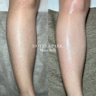 HOTEL&PARK Mikuワックス脱毛のエステ・リラクイメージ
