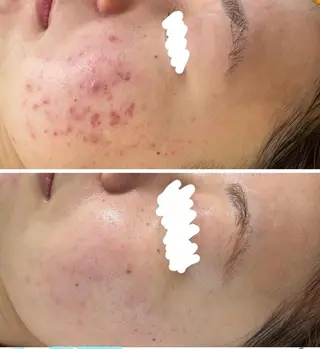 Lam.. .のエステ・リラクイメージ