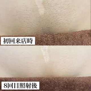 毛穴改善/脱毛 ネイル　川上久仁子のエステ・リラクイメージ