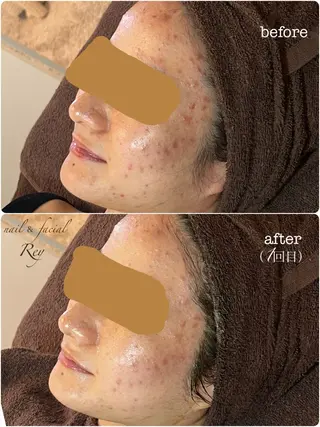 R eyのネイルデザイン