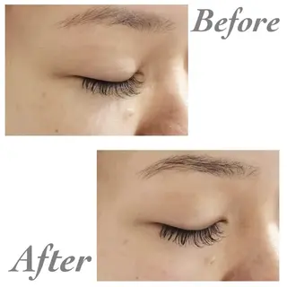 小顔・ツルツル素肌 ハリステリアのエステ・リラクイメージ