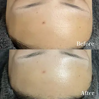 𝐌𝐚𝐜𝐡𝐞 𝐛𝐲 𝐌𝐚𝐲𝐮所属・ハーブピーリング🌿 𝑴𝒂𝒚𝒖のエステ・リラクイメージ