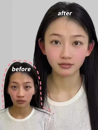 マツエク・マツパ aliaハイフ&水光ジェットサロン所属・aliaハーブ水光店 エステティシャン募集のエステ・リラクイメージ