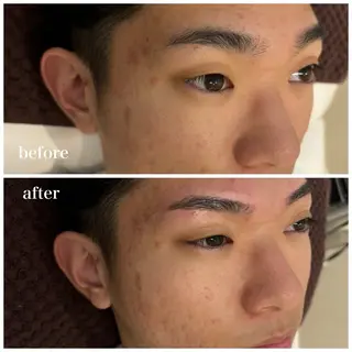 メンズ アイブロウ 眉毛サロンOMEN'S 栄店所属・メンズ眉毛サロン オーメンズ栄店の眉毛・アイブロウイメージ