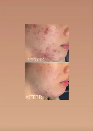 knoté 🦋Nittaのエステ・リラクイメージ