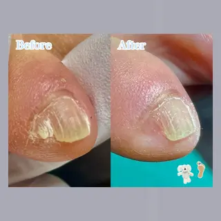 巻き爪補正店 大阪天王寺店のネイルデザイン