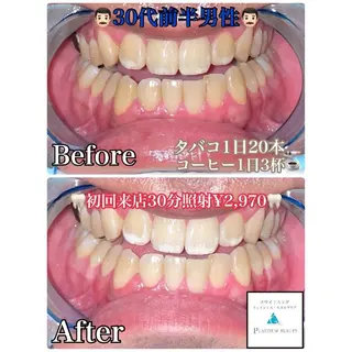 セルフホワイトニングビューティー三川店所属・中村 江梨香のその他イメージ