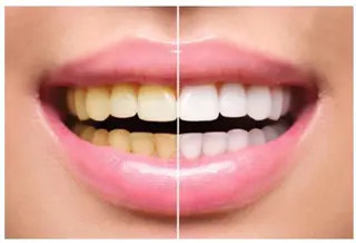 ベルーテ エッセンスのエステ・リラクイメージ