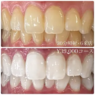 メンズ ホワイトニングルーム　川崎店所属・ホワイトニング ルーム　川崎店のその他イメージ