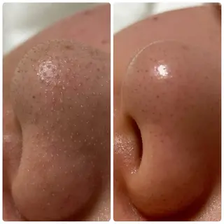 春木 幸子のエステ・リラクイメージ