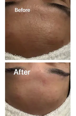 トータルビューティー サロン・Ｎの眉毛・アイブロウイメージ