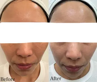 beautysalon LIMOA所属・松本 愛絵理のエステ・リラクイメージ