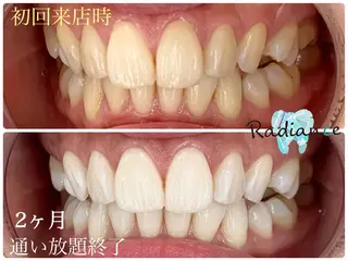 札幌ホワイトニング ラディアンス札幌駅店のその他イメージ