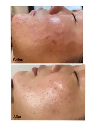 肌質改善サロン La Divinaのエステ・リラクイメージ