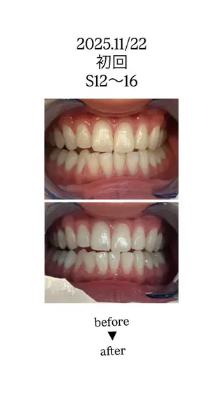 セルフホワイトニングサロンエクシアホワイト倉敷店所属・ecxiawhite 倉敷店のエステ・リラクイメージ