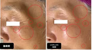 ヴィーナス ビューティーのエステ・リラクイメージ