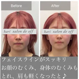 整体×美容鍼灸 鍼灸師Miyanoのエステ・リラクイメージ