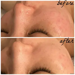 メンズ メナード岐阜市茜部 杉浦のエステ・リラクイメージ