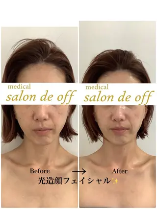 🩵Tatsumi Kana🩵のエステ・リラクイメージ