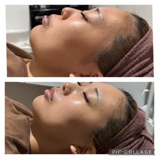 ニキビケア専門サロン Unityのエステ・リラクイメージ