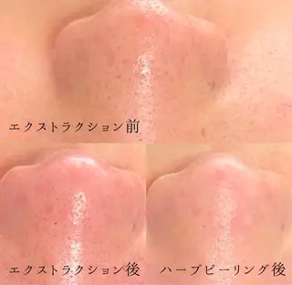 プライベートサロン emma【エマ】のその他イメージ