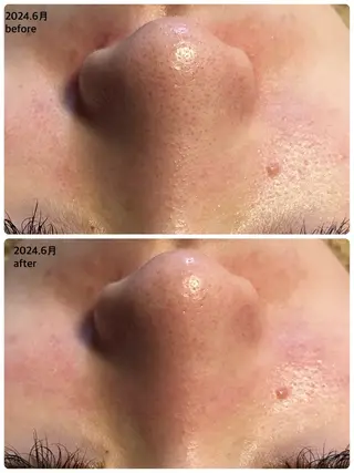 ピーリング専門店 Belluteのエステ・リラクイメージ