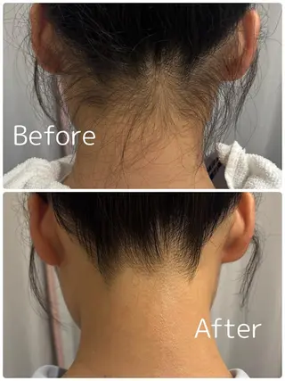 ビューティーフェイス トナリエ宇都宮店のエステ・リラクイメージ