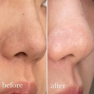 De'Im柴田所属・DeI'm 鈴木のその他イメージ