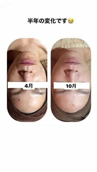 【足圧】鬼👹リンパ 身体整うサロンのエステ・リラクイメージ