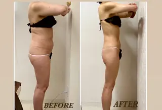 Prima〜プリマ〜 名古屋駅店所属・Prima 痩身脱毛 にごうかおりのエステ・リラクイメージ