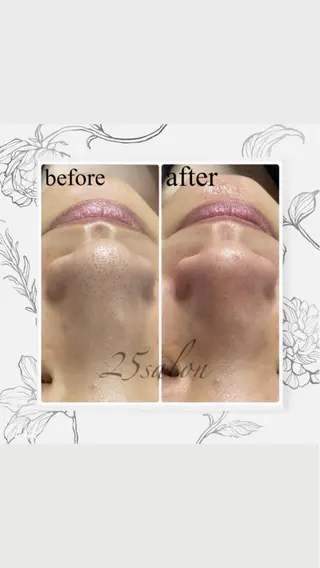 25salon所属・25salon MIHOのエステ・リラクイメージ