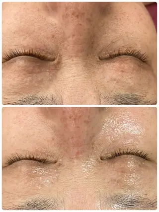 Chalon所属・REVI取扱・肌悩み 毛穴Chalonのエステ・リラクイメージ