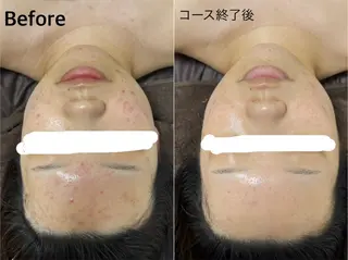 ビューティーサロン　ア・クイーユ所属・ビューティーサロン ア・クイーユのエステ・リラクイメージ