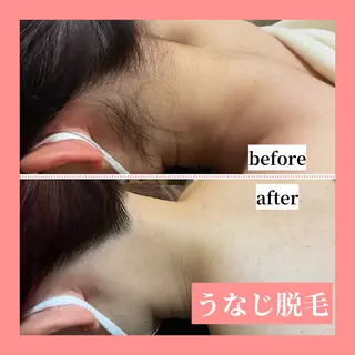 メンズ 天神【効果重視脱毛】 YouMakeのエステ・リラクイメージ