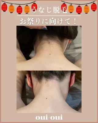 oui-oui　ウィウィ所属・oui-oui 磐田脱毛のエステ・リラクイメージ