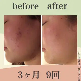 ショート カラー パーマ ヘアアレンジ メンズ キッズ ネイル マツエク・マツパ ニキビ・肌質改善専門 ♡人生が変わるサロンのエステ・リラクイメージ