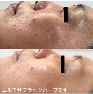 オールハンド フェイシャルのエステ・リラクイメージ