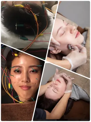 表参道鍼灸院K 美容鍼🔮ララピールのエステ・リラクイメージ