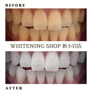 メンズ ホワイトニング ショップ新小岩店のその他イメージ