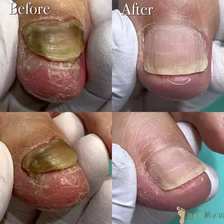 ネイル 東京巻き爪アカデミー所属・東京巻き爪 アカデミーのエステ・リラクイメージ