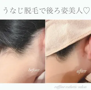 raffine  esthetic salon所属・🌻raffine 脱毛/まつ毛/ヘアーのエステ・リラクイメージ