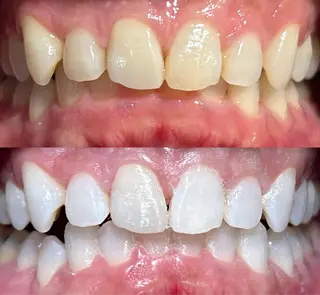 io teeth careのその他イメージ