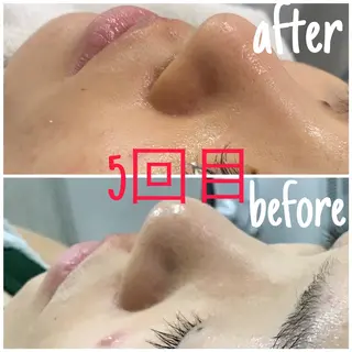 毛穴洗浄・痩身・脱毛 /アルカンジュのエステ・リラクイメージ