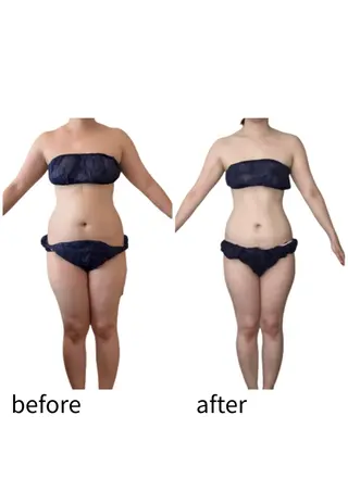 痩身専門サロン Coral✨のエステ・リラクイメージ