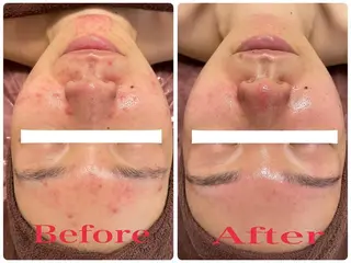 脱毛×肌管理サロン ルネルのエステ・リラクイメージ