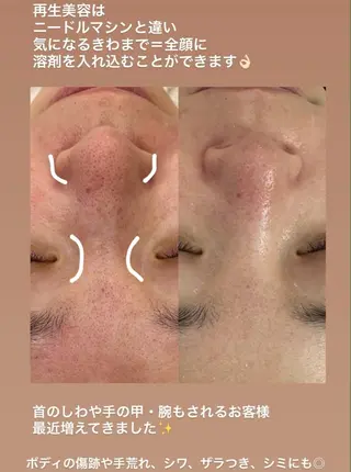 【福岡市西区 エステ】 GRANVIR(グランヴィール)所属・GRANVIR グランヴィールのエステ・リラクイメージ