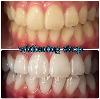 ホワイトニング ショップ吉祥寺店のエステ・リラクイメージ