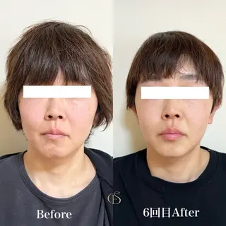 Beauty&Spa Sereno所属・beauty&spa Serenoの眉毛・アイブロウイメージ